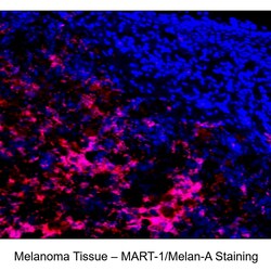 MART-1/Melan-A Mouse anti-Human, Alexa Fluor 647, Clone: A103 (also known