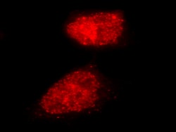 MilliporeSigma™ Chemicon™ LentiBrite™ RFP-Rad51 Lentiviral Biosensor