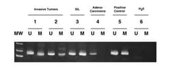 MilliporeSigma™ Chemicon™ CpG WIZ™ p16-Methylation Specific PCR Assay