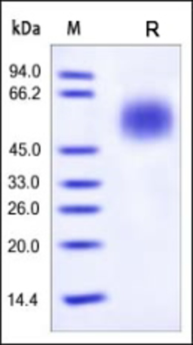 acrobiosystems-human-cd55-daf-protein-his-tag-100-ug-fisher-scientific