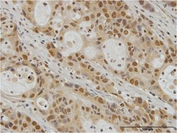 EGR1, Mouse anti-Human, Clone: 6E8, Abnova 100&mu;g; Unconjugated:Anticorps,