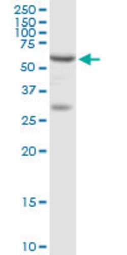 ADSL, Rabbit anti-Human, Polyclonal Antibody, Abnova 100&mu;g; Unconjugated:Antibodies,