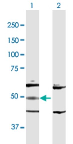 ADSL, Rabbit anti-Human, Polyclonal Antibody, Abnova 100&mu;g; Unconjugated:Antibodies,