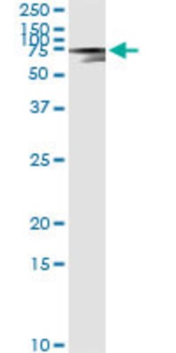 AFP, Mouse anti-Human, Clone: 1G7, Abnova 100&mu;g; Unconjugated:Antibodies,