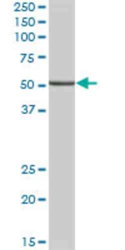 ALDH9A1, Mouse anti-Human, Polyclonal Antibody, Abnova 50&mu;g; Unconjugated:Antibodies,