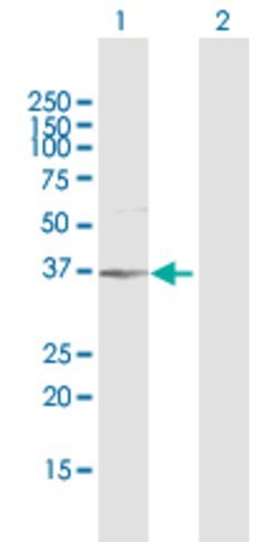 AKR1B1, Rabbit anti-Human, Polyclonal Antibody, Abnova 100 &mu;g | Buy Online | Abnova | Fisher Scientific