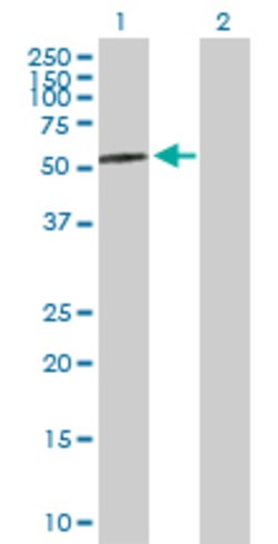 AMY2A, Rabbit anti-Human, Polyclonal Antibody, Abnova 100&mu;g; Unconjugated:Antibodies,