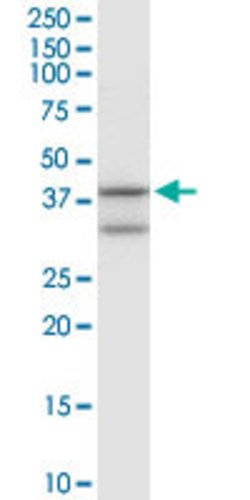 ANXA1, Rabbit anti-Human, Polyclonal Antibody, Abnova 100&mu;L; Unconjugated:Antibodies,