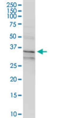 ANXA1, Rabbit anti-Human, Polyclonal Antibody, Abnova 100&mu;L; Unconjugated:Antibodies,