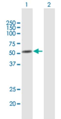 ANXA11, Mouse anti-Human, Polyclonal Antibody, Abnova 50&mu;g; Unconjugated:Antibodies,