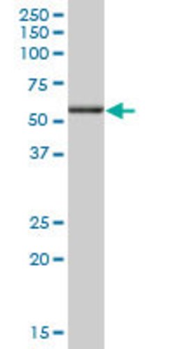 ANXA11, Mouse anti-Human, Polyclonal Antibody, Abnova 50&mu;g; Unconjugated:Antibodies,