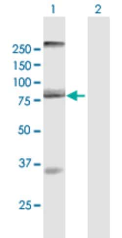 AOC2, Mouse anti-Human, Polyclonal Antibody, Abnova 50&mu;g; Unconjugated:Antibodies,