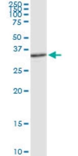 APEX1, Rabbit anti-Human, Polyclonal Antibody, Abnova 100&mu;g; Unconjugated:Antibodies,