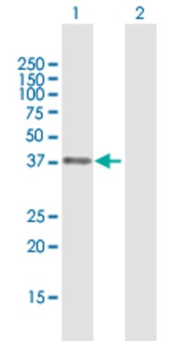 APEX1, Rabbit anti-Human, Polyclonal Antibody, Abnova 100&mu;g; Unconjugated:Antibodies,