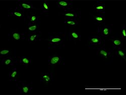 APEX1, Rabbit anti-Human, Polyclonal Antibody, Abnova 100&mu;g; Unconjugated:Antibodies,