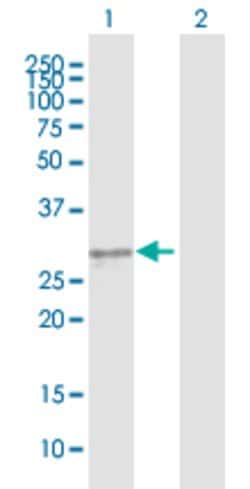 KLK3, Mouse anti-Human, Polyclonal Antibody, Abnova 50&mu;g; Unconjugated:Antibodies,