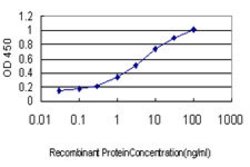 ABCC6, Mouse anti-Human, Clone: 1E6, Abnova 100&mu;g; Unconjugated:Antibodies,