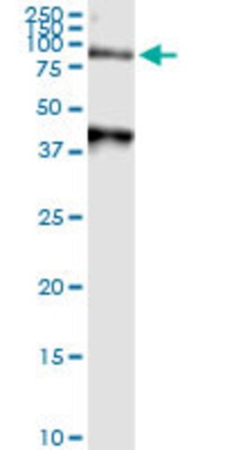 ARSA, Rabbit anti-Human, Polyclonal Antibody, Abnova 100&mu;L; Unconjugated:Antibodies,