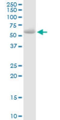 STS, Rabbit anti-Human, Polyclonal Antibody, Abnova 100&mu;L; Unconjugated:Antibodies,
