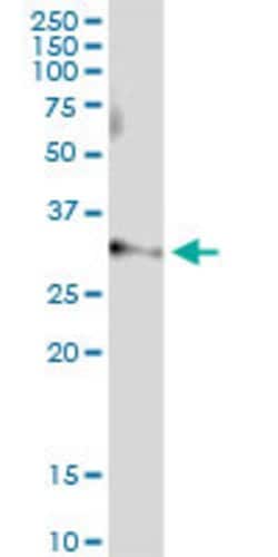 ART4, Rabbit anti-Human, Polyclonal Antibody, Abnova 100&mu;L; Unconjugated:Antibodies,