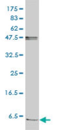 FXYD2, Mouse anti-Human, Clone: 1C3-B3, Abnova 100&mu;g; Unconjugated:Antibodies,