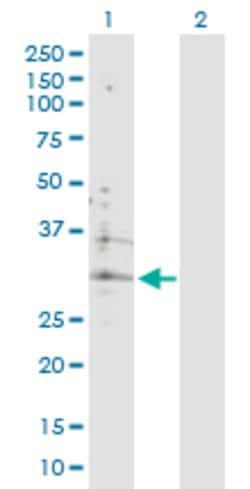 ATP6V0B, Rabbit anti-Human, Polyclonal Antibody, Abnova 100&mu;g; Unconjugated:Antikörper