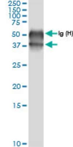 BCAT2, Rabbit anti-Human, Polyclonal Antibody, Abnova 100&mu;L; Unconjugated:Antibodies,