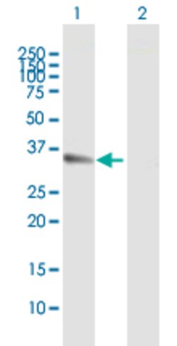 CCND1, Mouse anti-Human, Polyclonal Antibody, Abnova 50&mu;g; Unconjugated:Antibodies,
