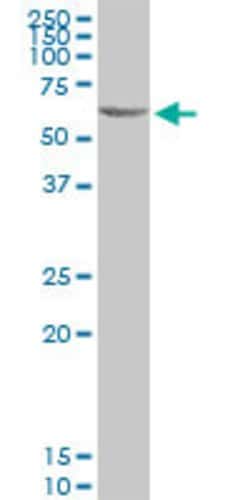 C3AR1, Mouse anti-Human, Polyclonal Antibody, Abnova 50&mu;g; Unconjugated:Antibodies,