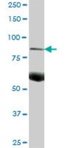 C7, Mouse anti-Human, Polyclonal Antibody, Abnova 50&mu;g; Unconjugated:Antibodies,