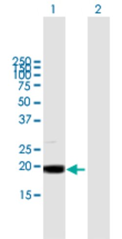 MRPL49, Mouse anti-Human, Polyclonal Antibody, Abnova 50 &mu;g | Buy Online | Abnova | Fisher Scientific