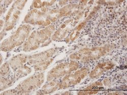MPPED1, Mouse anti-Human, Polyclonal Antibody, Abnova 50 &mu;g | Buy Online | Abnova Corporation | Fisher Scientific