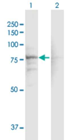 CACNB1, Rabbit anti-Human, Polyclonal Antibody, Abnova 100&mu;g; Unconjugated:Antibodies,