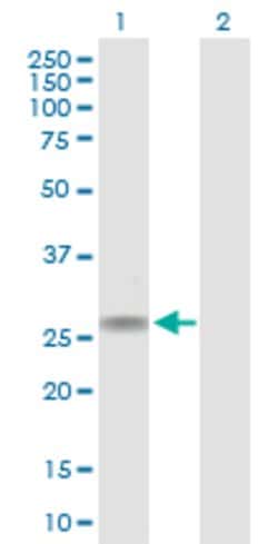 CACNG1, Rabbit anti-Human, Polyclonal Antibody, Abnova 100 &mu;g | Buy Online | Abnova | Fisher Scientific