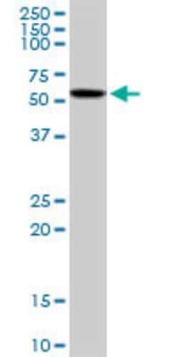CAMK4, Mouse anti-Human, Polyclonal Antibody, Abnova 50&mu;g; Unconjugated:Antibodies,