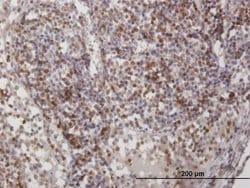 CD2, Mouse anti-Human, Polyclonal Antibody, Abnova 50&mu;g; Unconjugated:Antibodies,