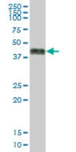 CD2, Mouse anti-Human, Polyclonal Antibody, Abnova 50&mu;g; Unconjugated:Antibodies,