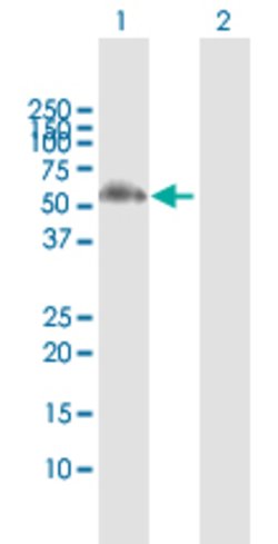 CDC25C, Rabbit anti-Human, Polyclonal Antibody, Abnova 100&mu;L; Unconjugated:Antibodies,