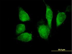 CDKN1B, Mouse anti-Human, Polyclonal Antibody, Abnova 50&mu;g; Unconjugated:Antibodies,