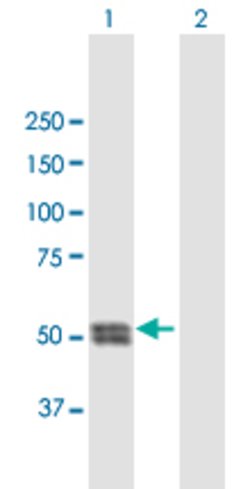 CTSC, Mouse anti-Human, Polyclonal Antibody, Abnova 50&mu;g; Unconjugated:Antibodies,