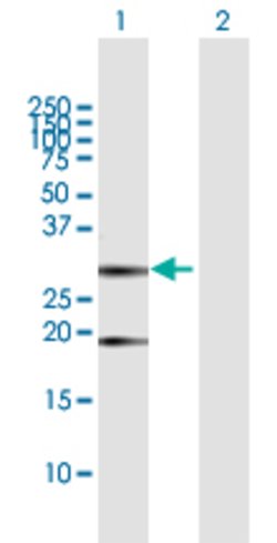 CLTB, Rabbit anti-Human, Polyclonal Antibody, Abnova 100&mu;L; Unconjugated:Antibodies,