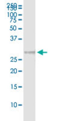 CLTB, Rabbit anti-Human, Polyclonal Antibody, Abnova 100&mu;L; Unconjugated:Antibodies,