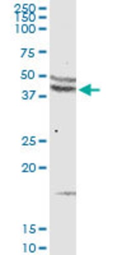 CCR5, Rabbit anti-Human, Polyclonal Antibody, Abnova 100&mu;g; Unconjugated:Antibodies,