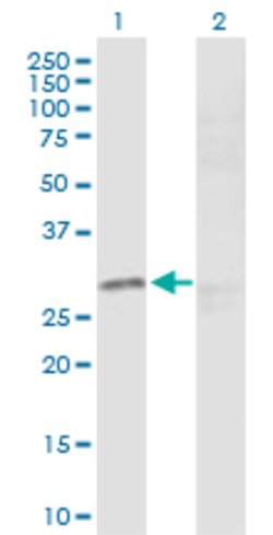 CREB1, Rabbit anti-Human, Polyclonal Antibody, Abnova 100&mu;g; Unconjugated:Antibodies,