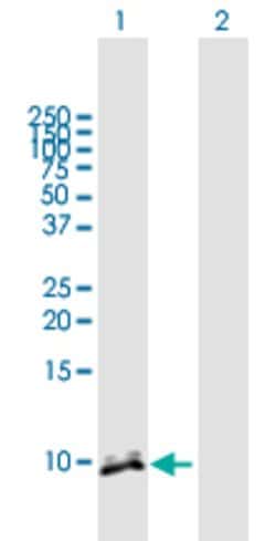 CRP, Mouse anti-Human, Polyclonal Antibody, Abnova 50&mu;g; Unconjugated:Antibodies,