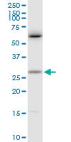 CTF1, Rabbit anti-Human, Polyclonal Antibody, Abnova 100&mu;g; Unconjugated:Antibodies,