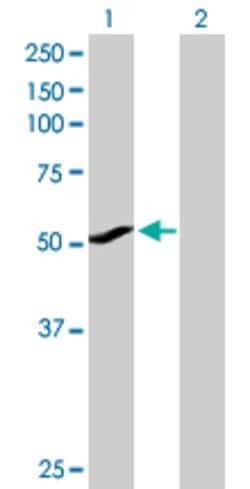 CYP1A1, Rabbit anti-Human, Polyclonal Antibody, Abnova 100&mu;g; Unconjugated:Antibodies,