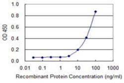 CYP2A6, Mouse anti-Human, Clone: 3B11, Abnova 100&mu;g; Unconjugated:Antibodies,