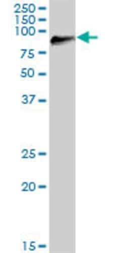 DGKG, Mouse anti-Human, Polyclonal Antibody, Abnova 50 &mu;g | Buy Online | Abnova | Fisher Scientific