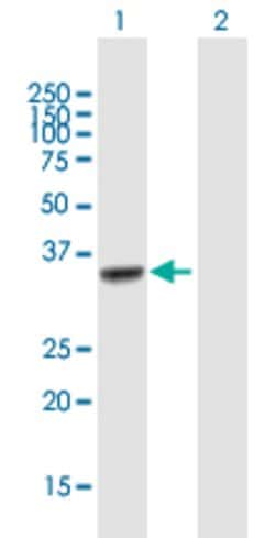 DBC1, Mouse anti-Human, Polyclonal Antibody, Abnova 50&mu;g; Unconjugated:Antibodies,